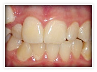 Dentist Dental In Pattaya