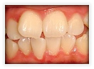 Dentist Dental In Pattaya