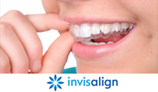 Invisalign