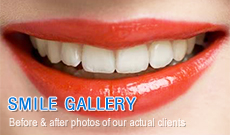 Smile Gallery