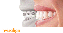 invisalign