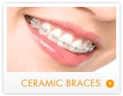 ceramic braces