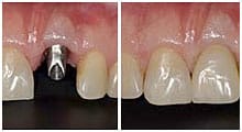 Dentist Dental In Pattaya