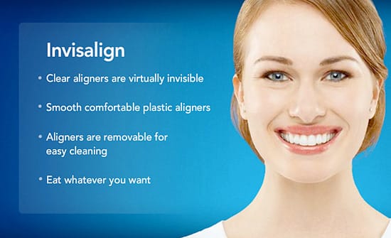 What is Invisalign?