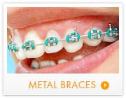 metal braces