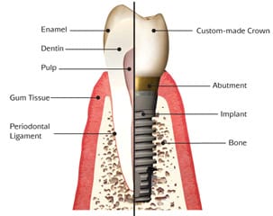 jawbone