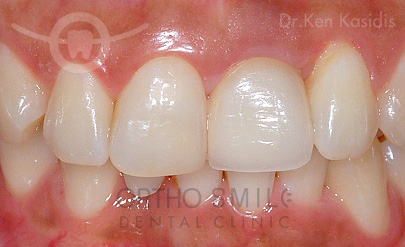 orthosmile_sr_dental_imgd.jpg