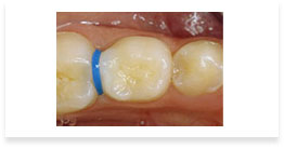 Dentist Pattaya, Dental Pattaya, Implant Pattaya, ทำฟัน พัทยา, จัดฟัน  พัทยา, ชลบุรี